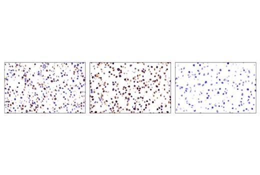Immunohistochemistry Image 1: Phospho-SLP-76 (Ser376) (E3G9U) Rabbit Monoclonal Antibody (BSA and Azide Free)