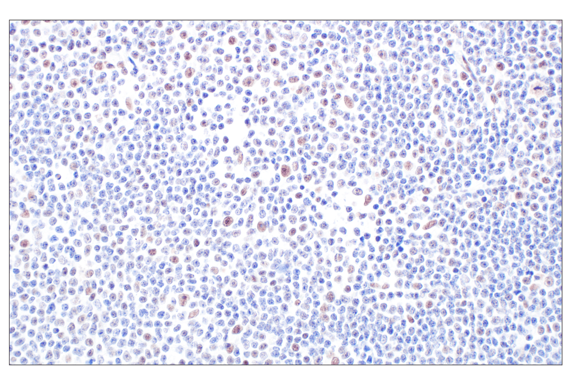 Immunohistochemistry Image 3: HDAC2 (3F3) Mouse Monoclonal Antibody