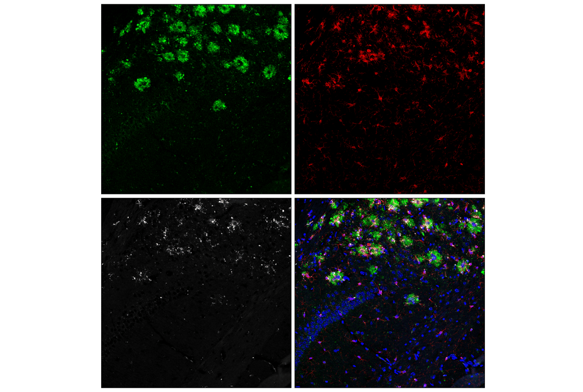 Immunofluorescence Image 2: TMEM106B (E7H7Z) Rabbit Monoclonal Antibody