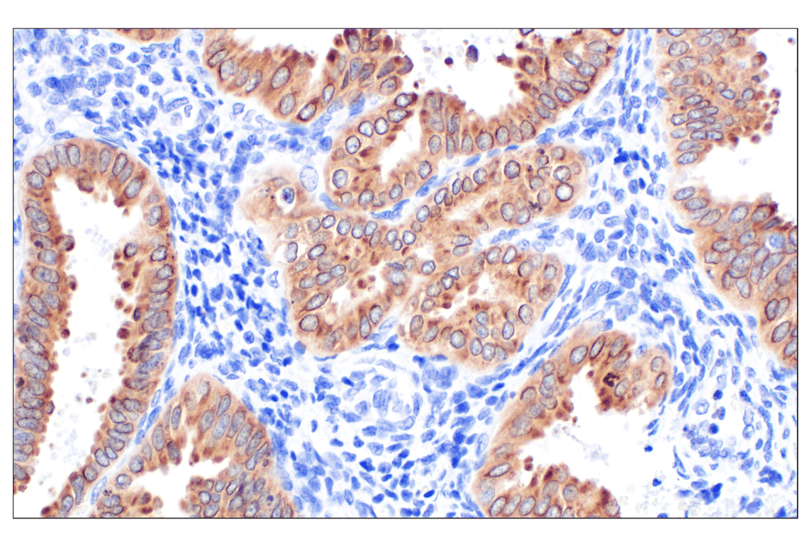 Immunohistochemistry Image 6: MGST1 (F6F5T) Rabbit Monoclonal Antibody