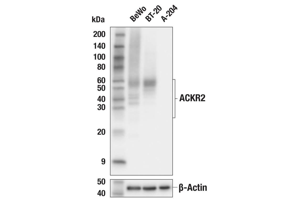 Western Blotting Image 2: ACKR2 (E9J8U) Rabbit Monoclonal Antibody