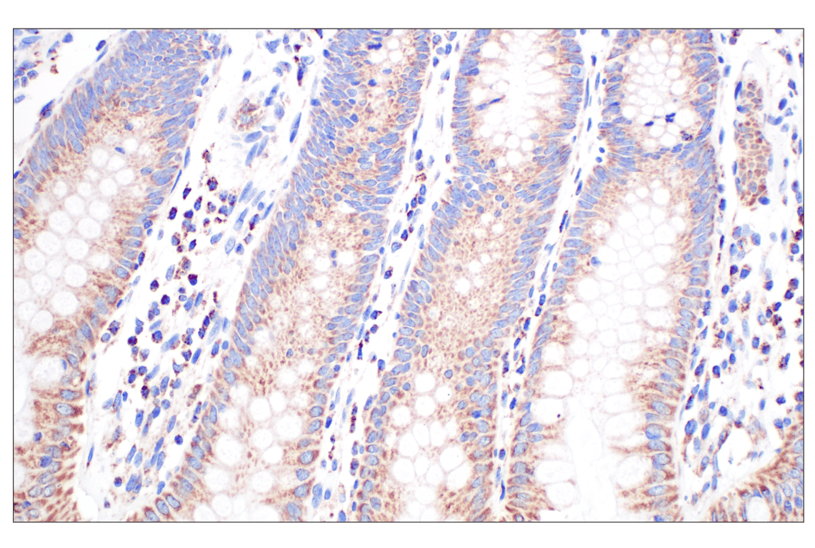 Immunohistochemistry Image 7: GCDH (F2P2M) Rabbit Monoclonal Antibody