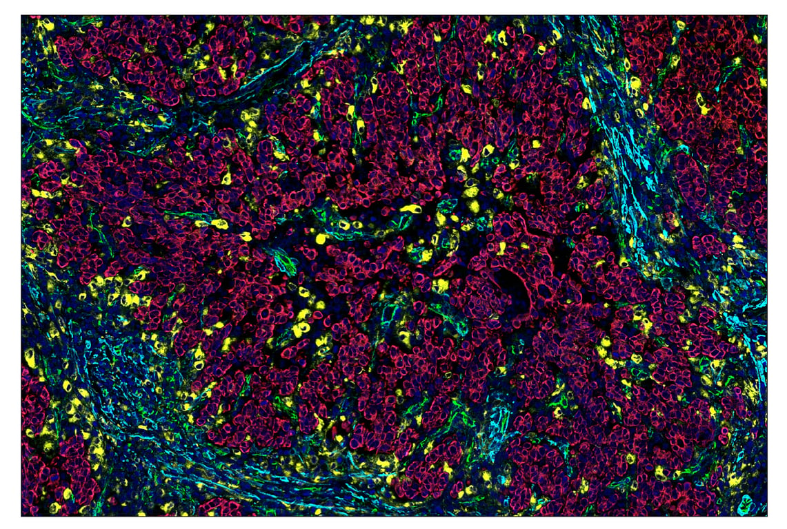Immunohistochemistry Image 7: CD68 (D4B9C) & CO-0007-647 SignalStar<sup>™</sup> Oligo-Antibody Pair