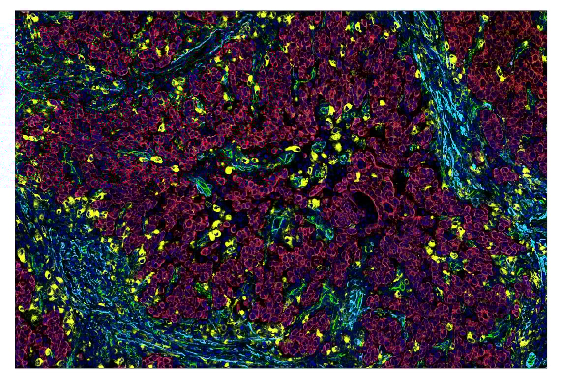 Immunohistochemistry Image 7: CD68 (D4B9C) & CO-0007-750 SignalStar<sup>™</sup> Oligo-Antibody Pair