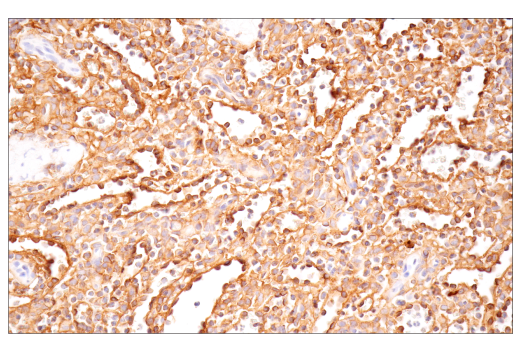 Immunohistochemistry Image 6: CD54/ICAM-1 (E3Q9N) Rabbit Monoclonal Antibody (BSA and Azide Free)