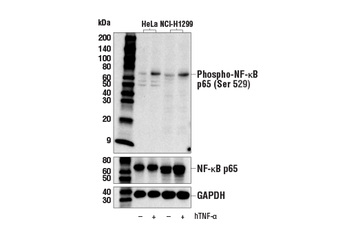 undefined Image 13: NF-kappaB Pathway Antibody Sampler Kit II