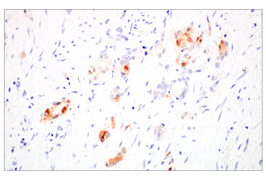 Immunohistochemistry Image 4: FGL1 (E7C1Q) Rabbit Monoclonal Antibody (BSA and Azide Free)