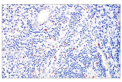 Immunohistochemistry Image 3: C/EBP beta (E2K1U) Rabbit Monoclonal Antibody