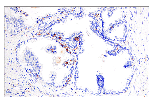 Immunohistochemistry Image 3: HLA-DRA (E9R2Q) XP<sup>®</sup> Rabbit mAb (BSA and Azide Free)