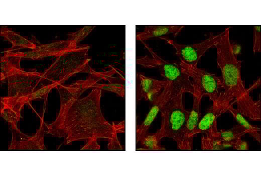 undefined Image 11: ER Stress Antibody Sampler Kit