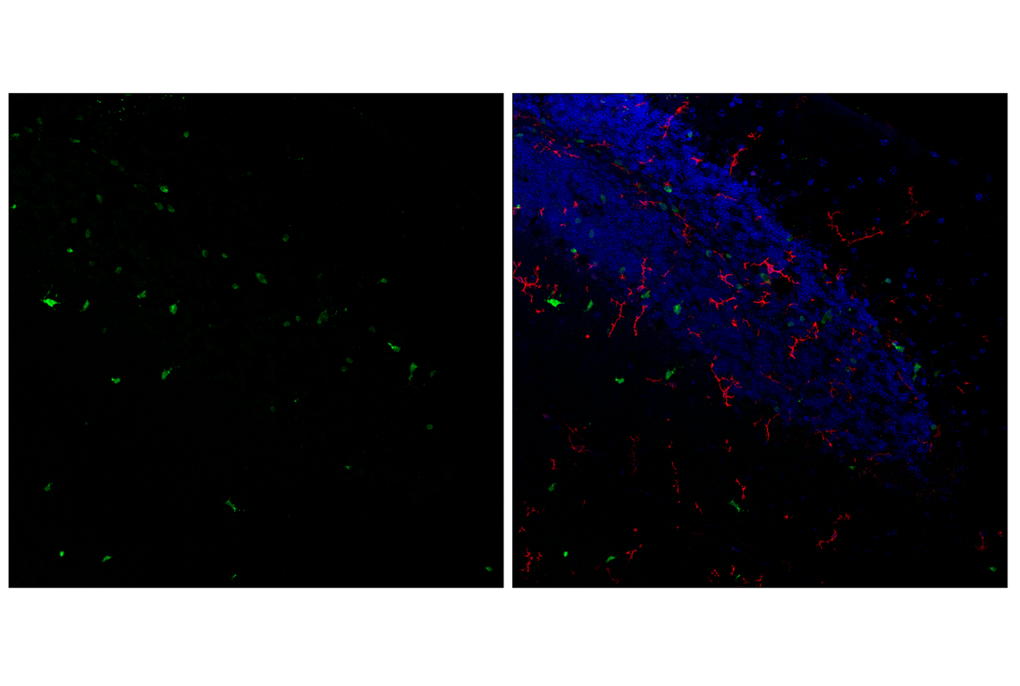 Immunofluorescence Image 1: Olig1 (E3T6D) Rabbit Monoclonal Antibody