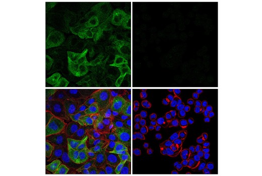 Immunofluorescence Image 1: MAP2 Antibody