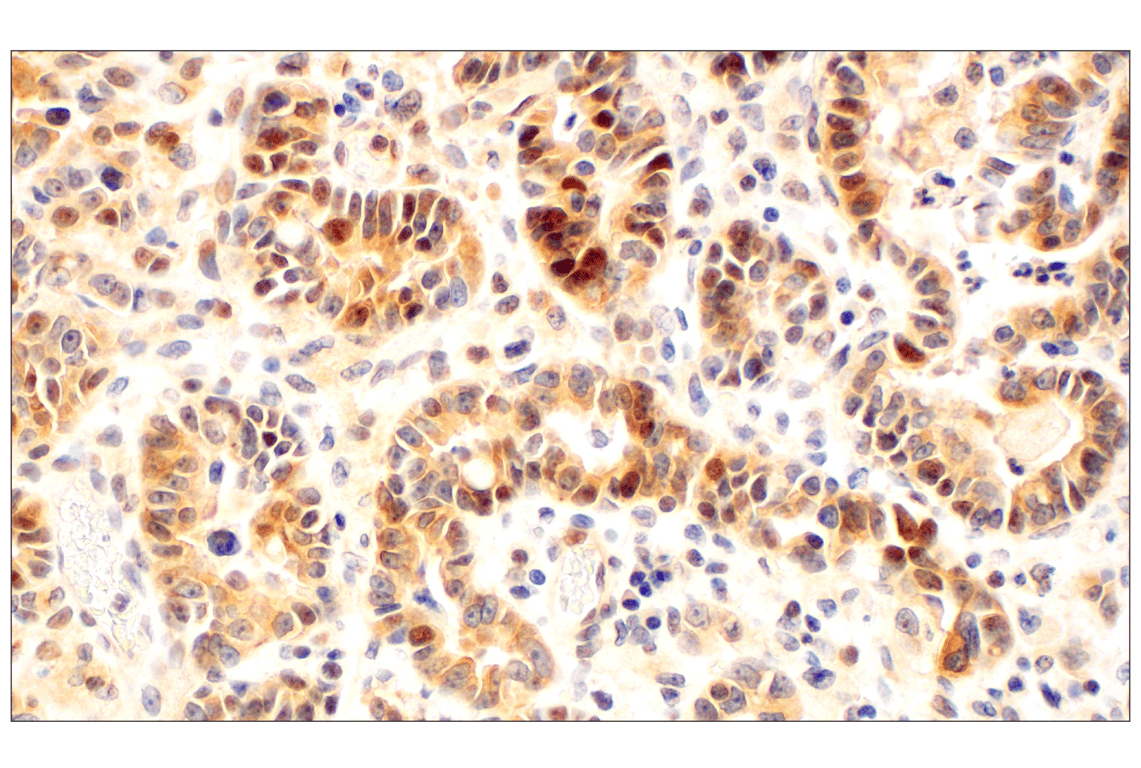 undefined Image 4: PhosphoPlus<sup>®</sup> AMPKα (Thr172) Antibody Duet