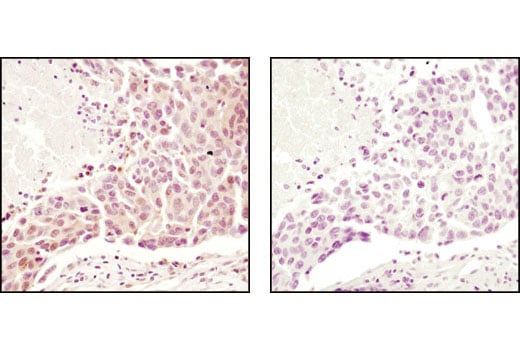 Immunohistochemistry Image 1: Ubiquitin Antibody