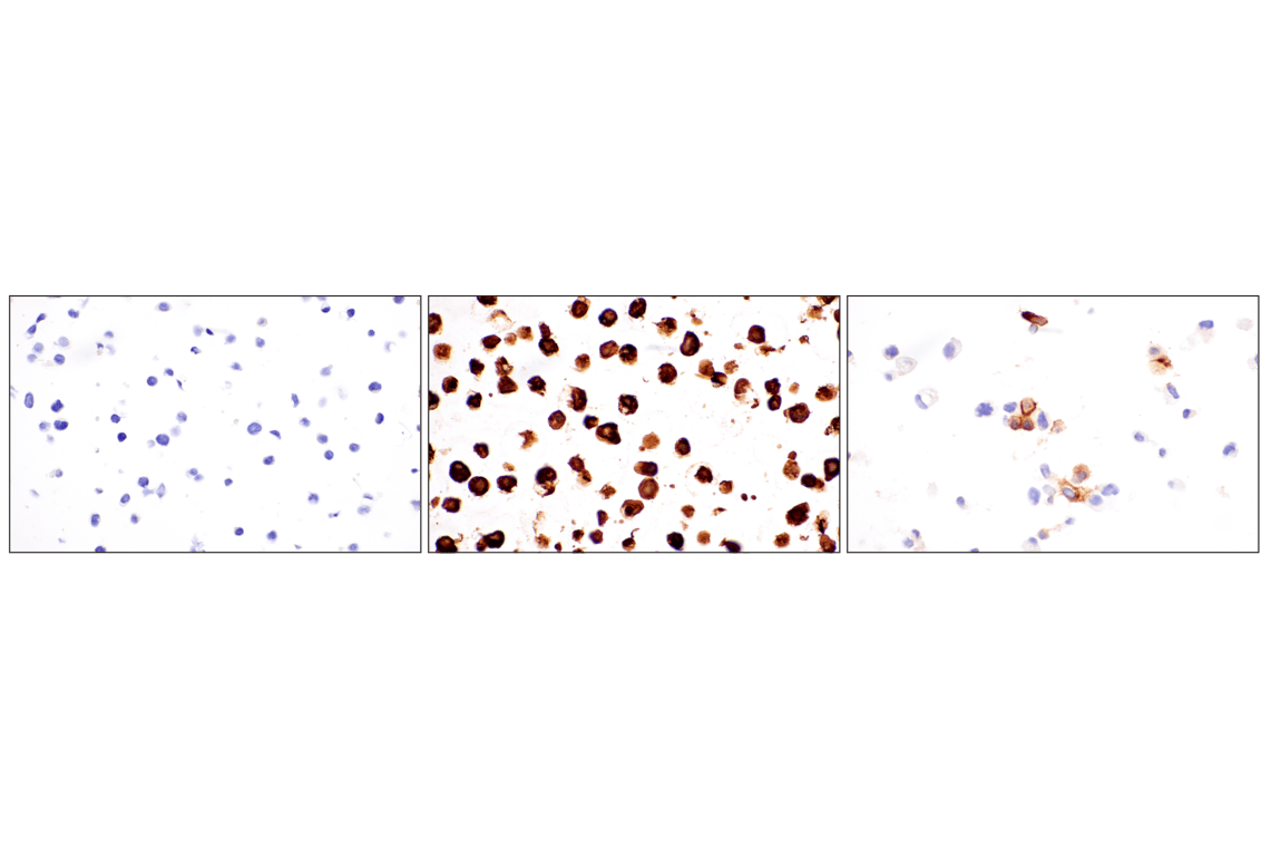 Immunohistochemistry Image 12: CEACAM7 (E5Q6X) Rabbit Monoclonal Antibody (BSA and Azide Free)