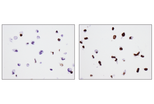 Immunohistochemistry Image 4: Phospho-Histone H2A.X (Ser139) (D7T2V) Mouse Monoclonal Antibody