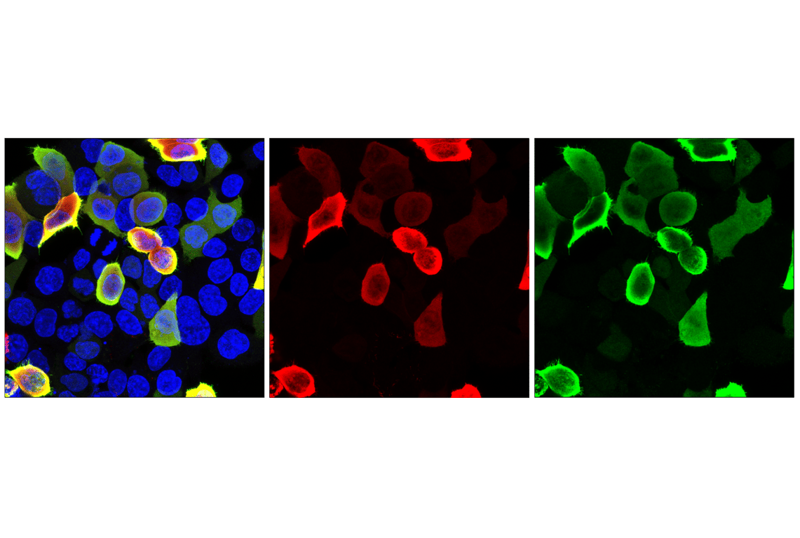 Immunofluorescence Image 1: HA-Tag (E3F8G) Mouse Monoclonal Antibody