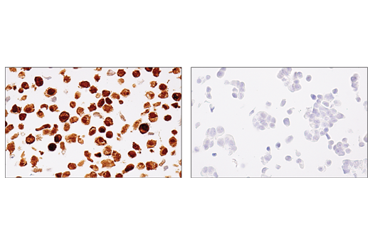 Immunohistochemistry Image 5: MAGE-A4 (E7O1U) Rabbit Monoclonal Antibody