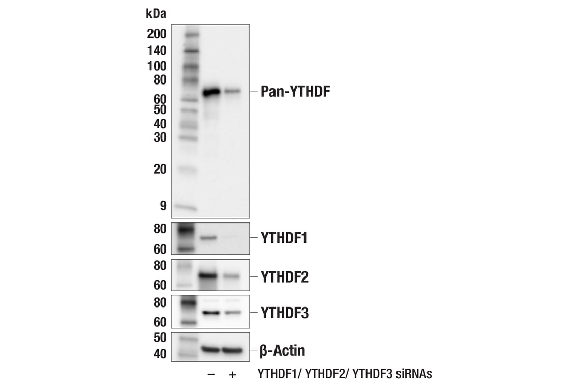 Western Blotting Image 2: Pan-YTHDF (E6C3O) Rabbit Monoclonal Antibody