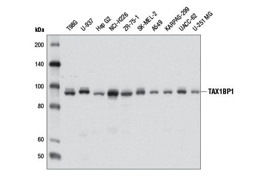 undefined Image 5: Xenophagy Antibody Sampler Kit