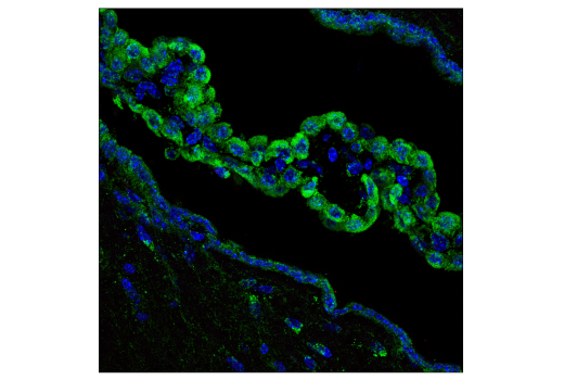 Immunofluorescence Image 1: FIS1 (E3K9O) Rabbit Monoclonal Antibody