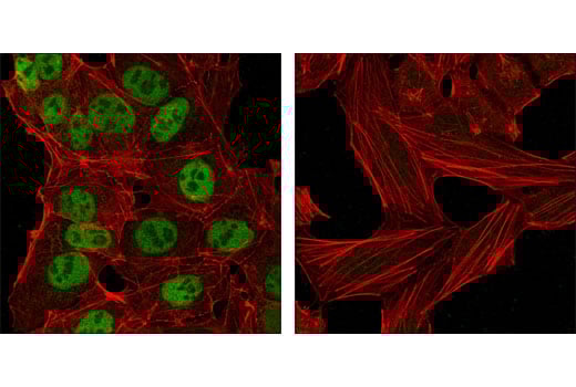 Immunofluorescence Image 1: Nanog (1E6C4) Mouse Monoclonal Antibody