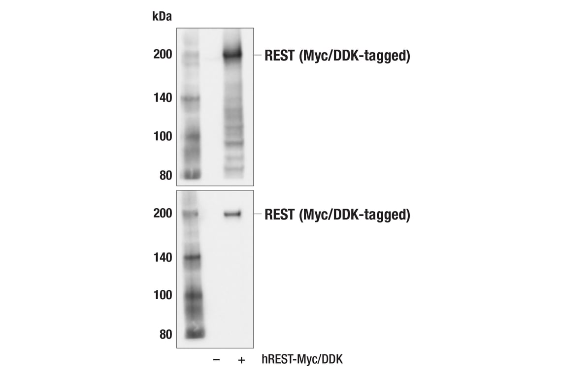 Western Blotting Image 2: REST (E3L2I) Rabbit Monoclonal Antibody