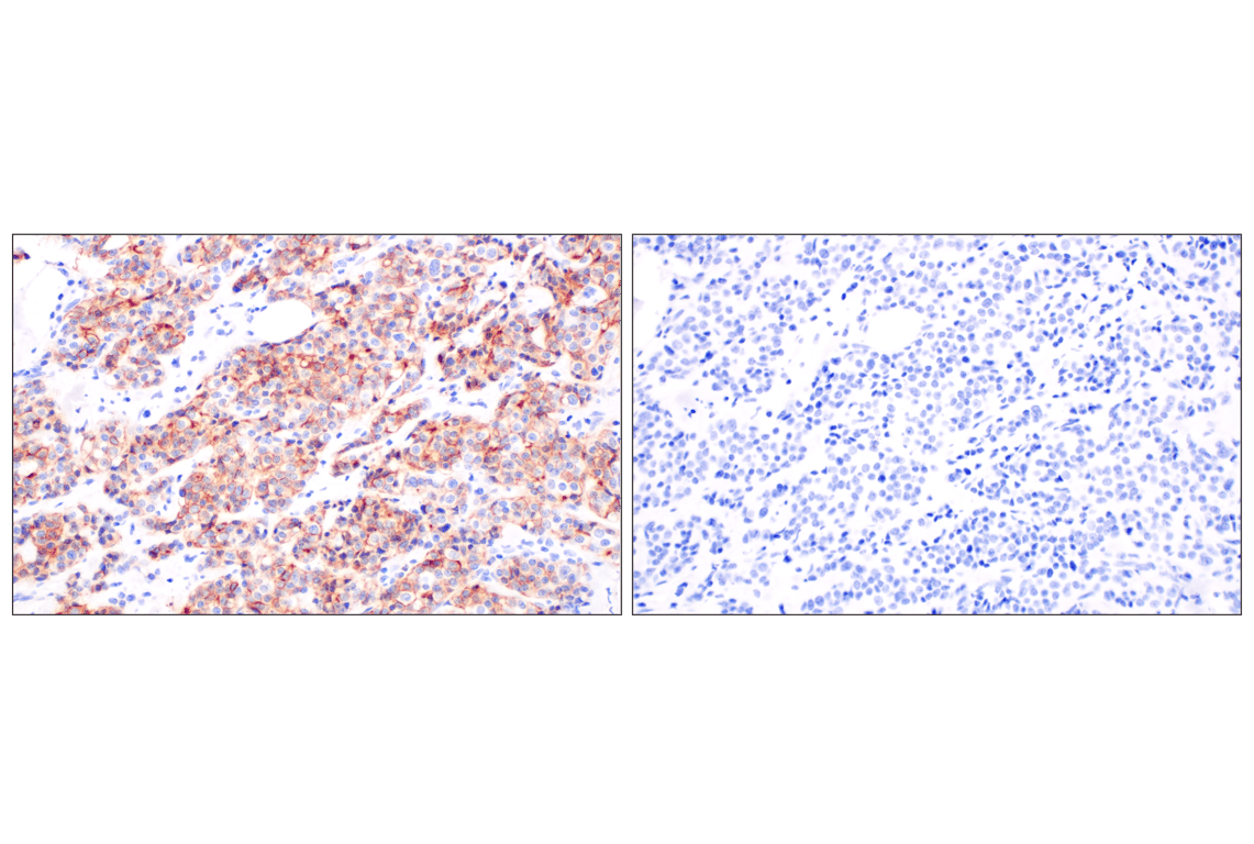 Immunohistochemistry Image 4: GFR alpha1 (F7R3F) Rabbit Monoclonal Antibody