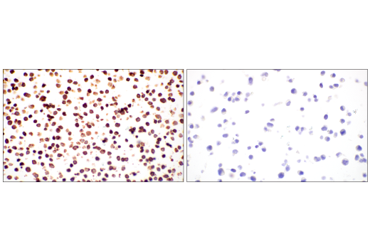 Immunohistochemistry Image 11: Lysozyme C-1/2 (E2K5R) Rabbit Monoclonal Antibody