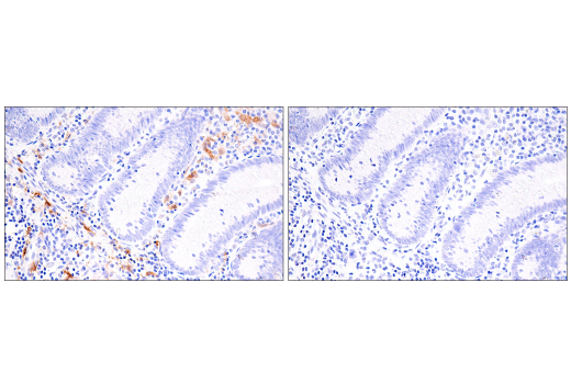 Immunohistochemistry Image 3: Factor XIIIA (E980.1) Mouse Monoclonal Antibody