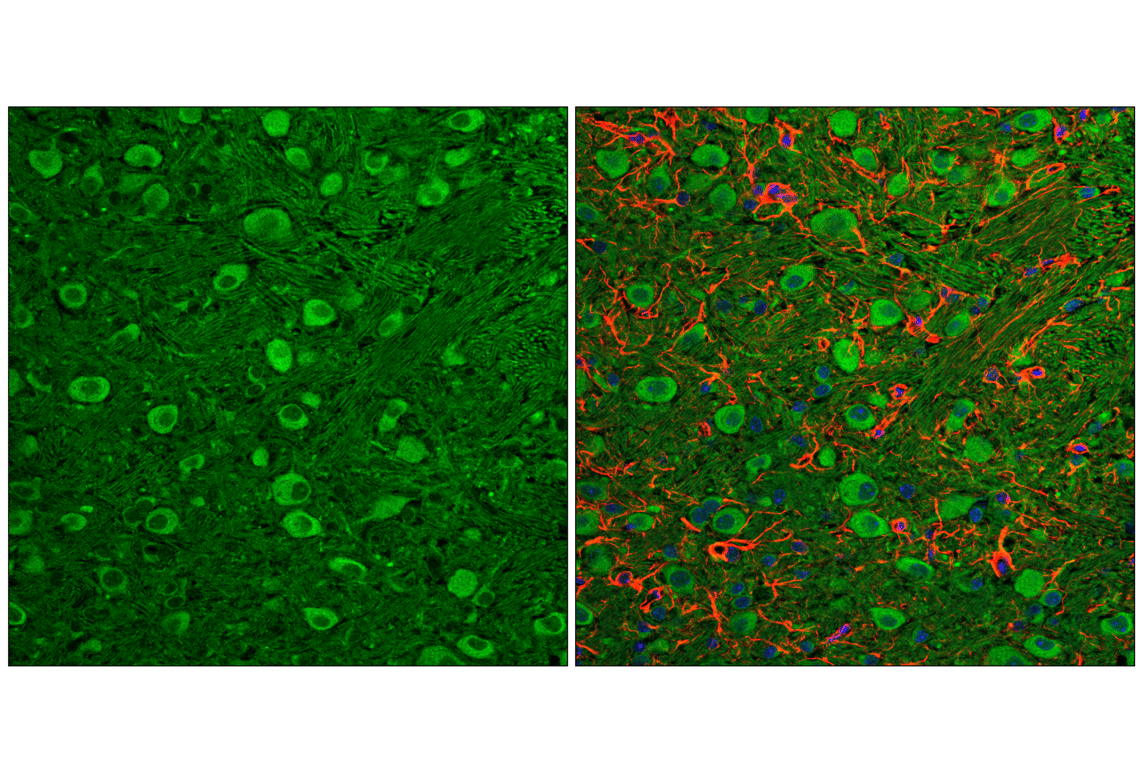 Immunofluorescence Image 2: LC3B (E5Q2K) Mouse Monoclonal Antibody (BSA and Azide Free)