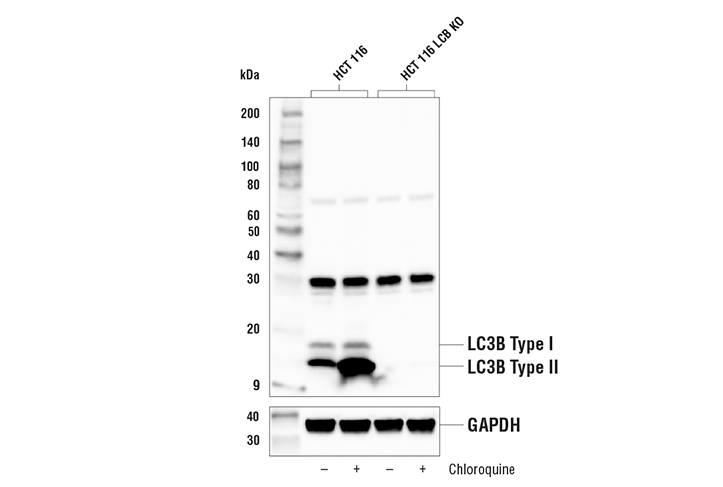 undefined Image 3: Xenophagy Antibody Sampler Kit