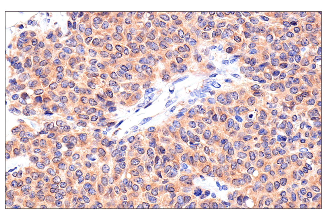 Immunohistochemistry Image 2: Caspase-8 (F5K9P) Rabbit Monoclonal Antibody