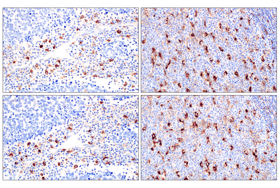 Cathepsin Z (F6D7U) Rabbit Monoclonal Antibody | Cell Signaling