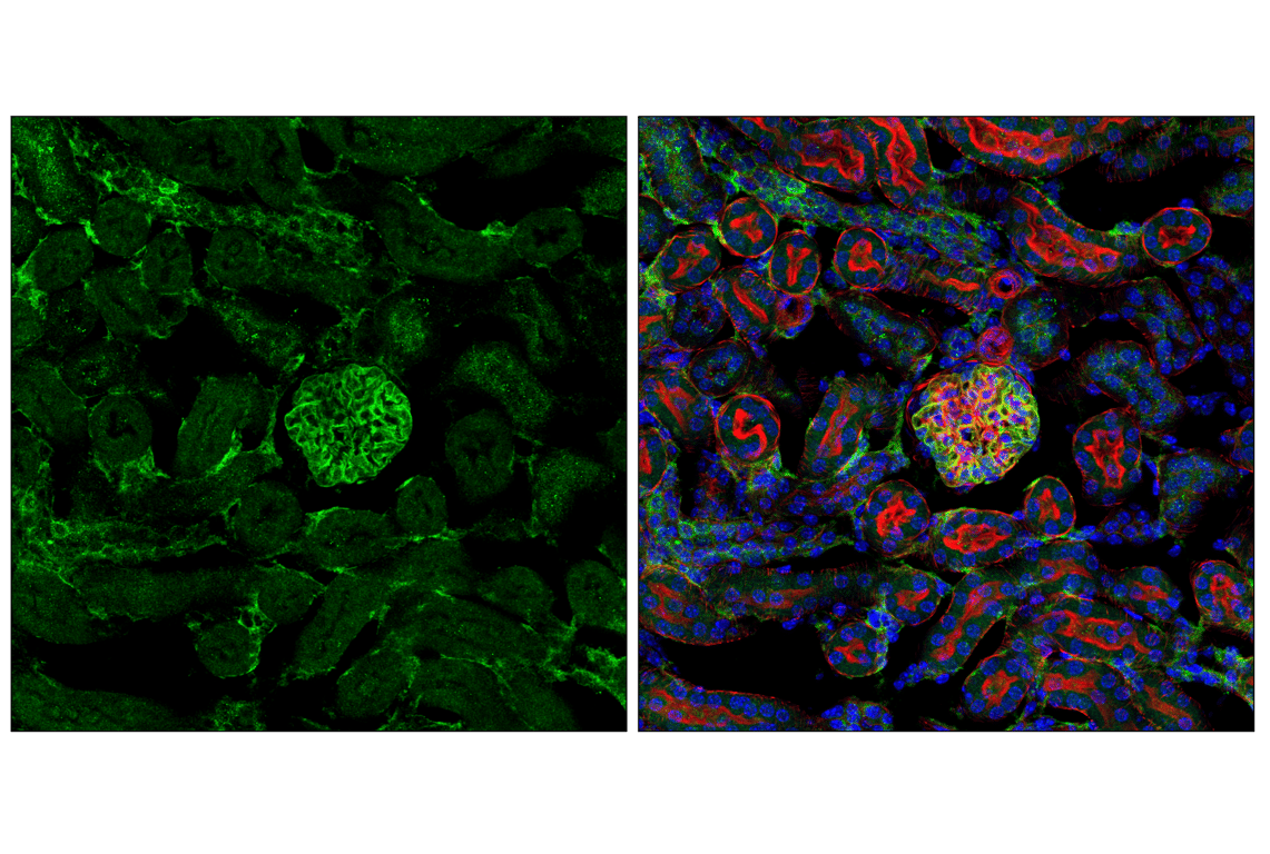 Immunofluorescence Image 2: ROBO2 (E4M6D) Rabbit Monoclonal Antibody