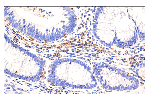 Immunohistochemistry Image 2: HPK1 (E1C3L) Rabbit Monoclonal Antibody (BSA and Azide Free)