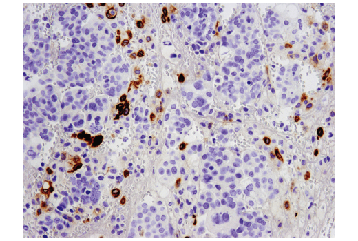 Immunohistochemistry Image 1: TIM-4 (D3W4F) Rabbit Monoclonal Antibody (BSA and Azide Free)