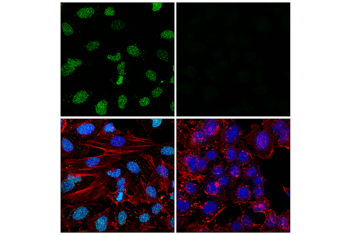 Immunofluorescence Image 2: Poly/Mono-ADP Ribose (D9P7Z) Rabbit Monoclonal Antibody (BSA and Azide Free)
