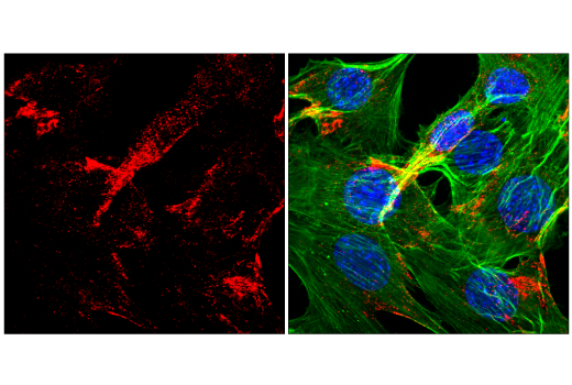 Immunofluorescence Image 2: Caveolin-1 (D46G3) XP<sup>®</sup> Rabbit mAb (Alexa Fluor<sup>®</sup> 647 Conjugate)