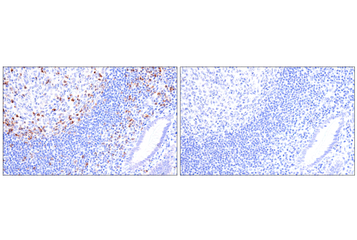 Immunohistochemistry Image 10: CTLA-4 (E2V1Z) Rabbit mAb (BSA and Azide Free)