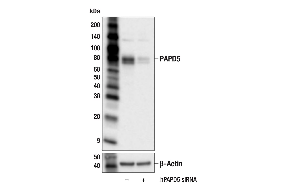Western Blotting Image 2: PAPD5 (E9A5D) Rabbit Monoclonal Antibody