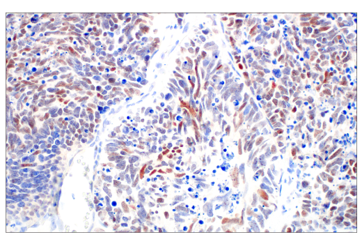 Immunohistochemistry Image 1: POU2F3 (E5N2D) Rabbit Monoclonal Antibody