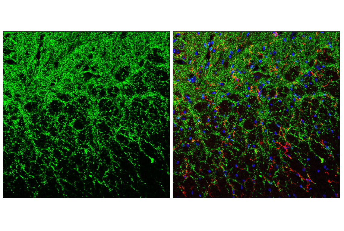 Immunofluorescence Image 3: VGAT Antibody