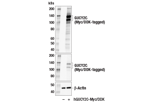 Western Blotting Image 2: GUCY2C (E6I2U) Rabbit Monoclonal Antibody