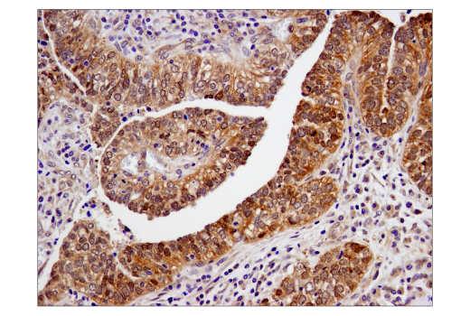 Immunohistochemistry Image 1: SMAD4 (D3R4N) Rabbit Monoclonal Antibody (BSA and Azide Free)