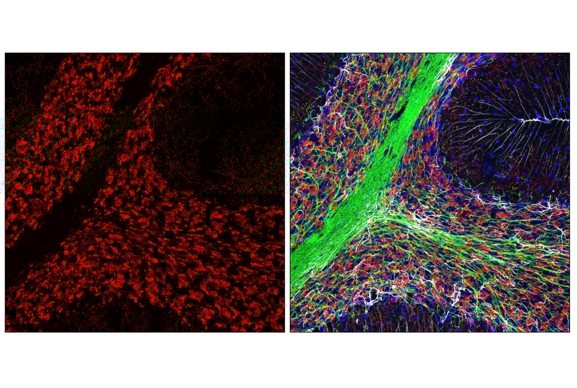 Immunofluorescence Image 2: VGLUT2 (E7P9K) Rabbit Monoclonal Antibody