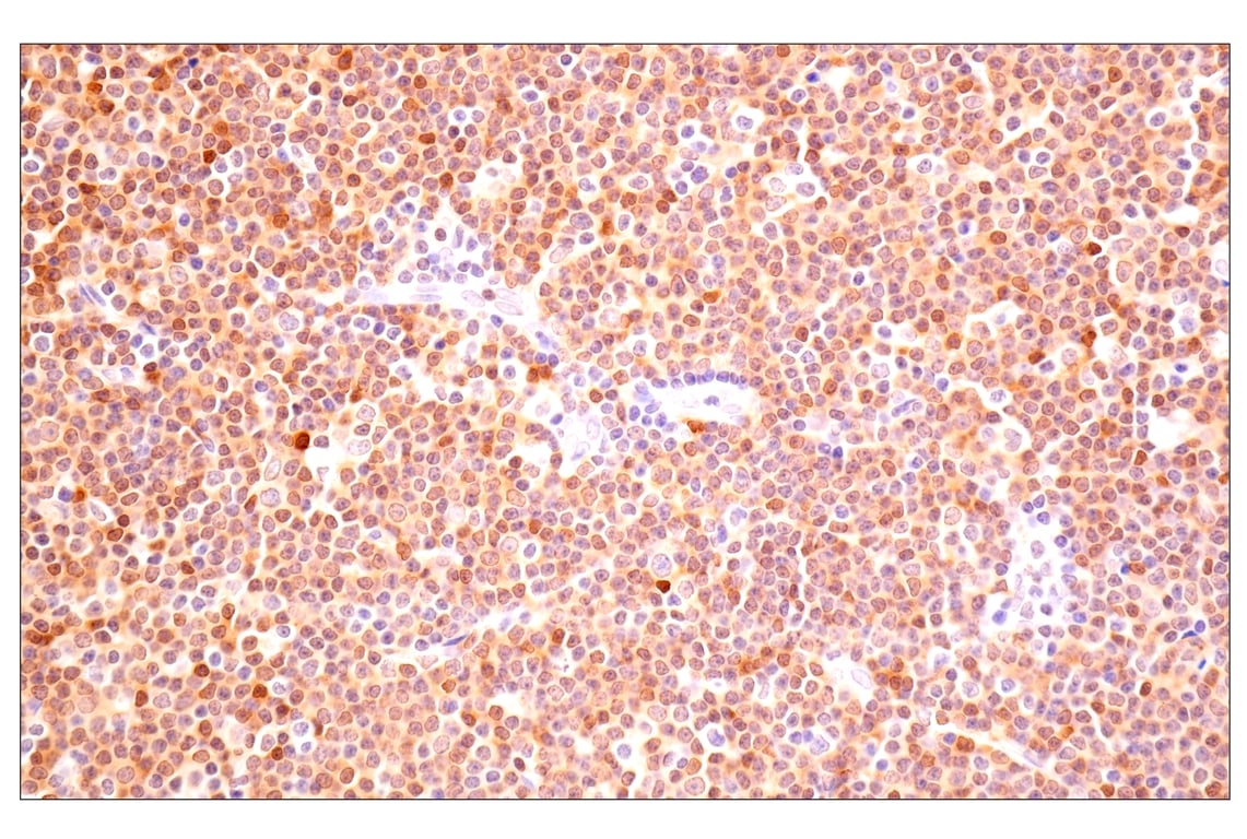 Immunohistochemistry Image 3: ACBP/DBI (E6K8G) Rabbit Monoclonal Antibody
