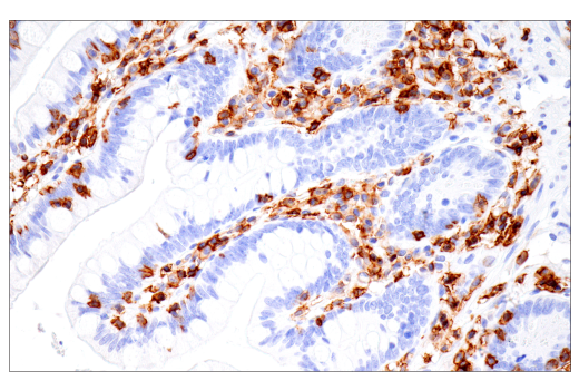 Immunohistochemistry Image 6: CD43 (MT1) Mouse Monoclonal Antibody