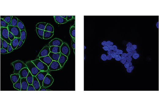 Immunofluorescence Image 1: Catenin delta-1 (D7S2M) Rabbit Monoclonal Antibody