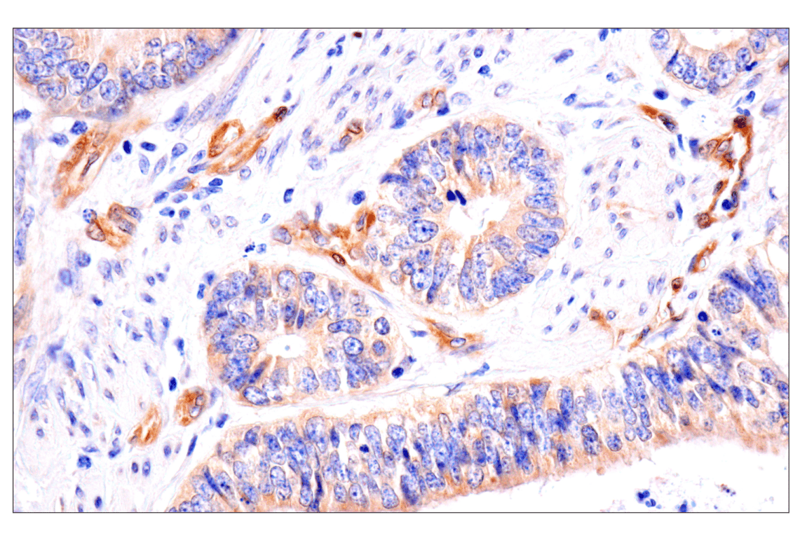 Immunohistochemistry Image 4: FAK (F7Z4C) Mouse Monoclonal Antibody